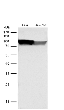 EEF2 Rabbit mAb  [KD Validated]