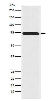Menin Rabbit mAb