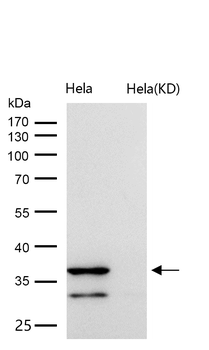 Cathepsin L/V/K/H Rabbit mAb