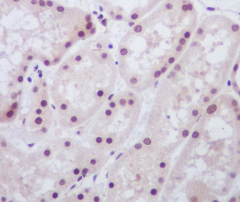 MAD2L1BP Rabbit mAb