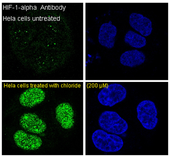 HIF-1 alpha Rabbit mAb