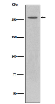 LRRK2 Rabbit mAb