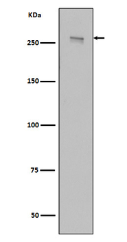 LRRK2 Rabbit mAb