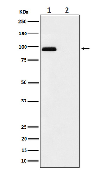 FGFR3 (Phospho-Tyr724) Rabbit mAb