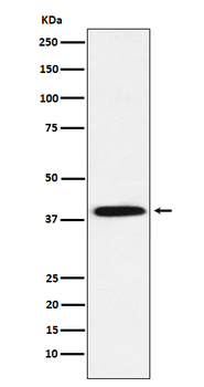 IKB alpha (Phospho-Ser36) Rabbit mAb