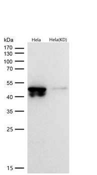 GSK3β(Phospho-Ser9) Rabbit mAb [KD Validated]