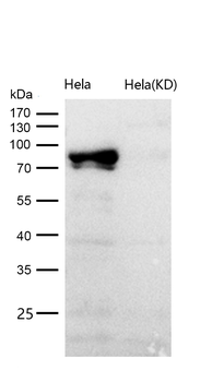 STAT3 (Phospho-Tyr705) Rabbit mAb [KD Validated]
