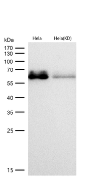 AMPK alpha 1 (Phospho-Ser496) Rabbit mAb [KD Validated]