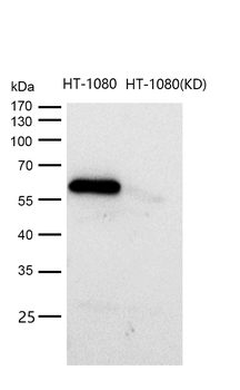 Smad2 (Phospho-Ser250) Rabbit mAb [KD Validated]
