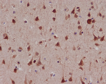 MSK1 (Phospho-Ser376) Rabbit mAb
