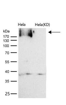 EGFR (Phospho-Tyr1173) Rabbit mAb [KD Validated]