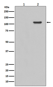 FAK (Phospho-Tyr397) Rabbit mAb