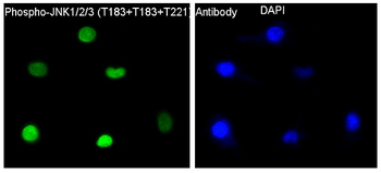 JNK1/2/3 (Phospho-Thr183+Thr183+Thr221) Rabbit mAb