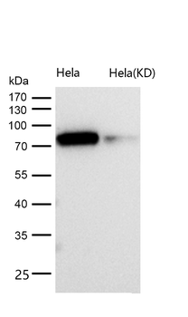Glycogen synthase 1 (Phospho-Ser641) Rabbit mAb [KD Validated]