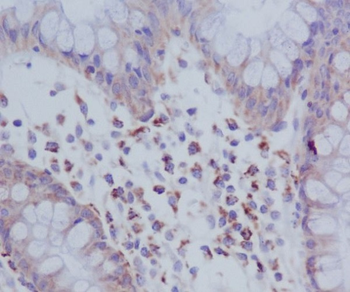 PKR (Phospho-Thr446) Rabbit mAb