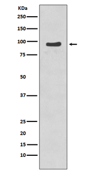 p95/NBS1 (Phospho-Ser343) Rabbit mAb