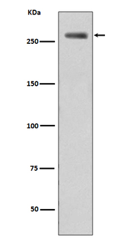 LRRK2 (Phospho-Ser935) Rabbit mAb