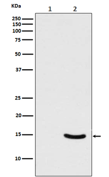 alpha Synuclein (Phospho-Ser129) Rabbit mAb