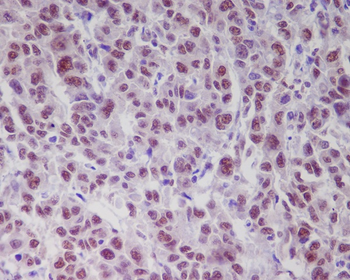 ATM (Phospho-Ser1981) Rabbit mAb