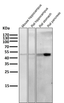 Cytokeratin 20 Antibody