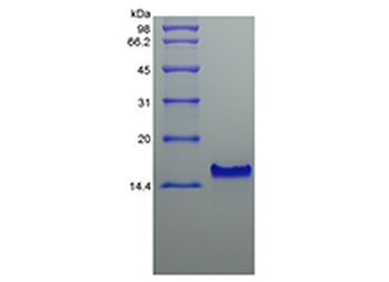 Recombinant Human Thymus Expressed Chemokine/CCL25