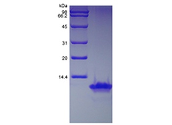 Recombinant Human Monocyte Chemotactic Protein-2/CCL8