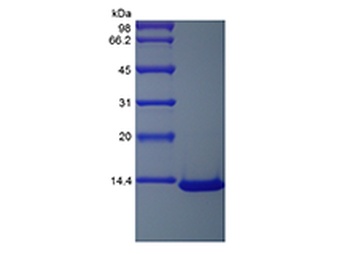 Recombinant Human Monocyte Chemotactic Protein-3/CCL7