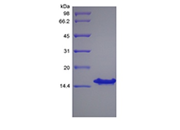 Recombinant Human Stromal-Cell Derived Factor-1 gamma/CXCL12 gamma