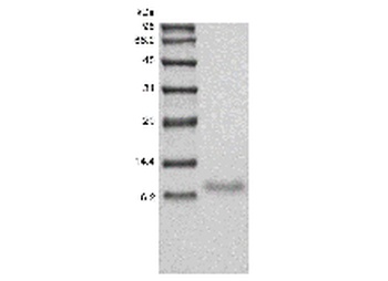 Recombinant Human TNF-related Weak Inducer of Apoptosis Receptor/TNFRSF12A