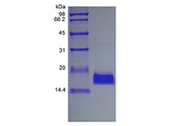 Recombinant Human Endothelial-Monocyte Activating Polypeptide II