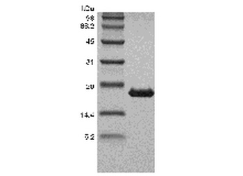 Recombinant Human Tumor Necrosis Factor-beta/TNFSF1