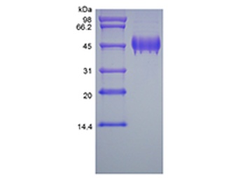 Recombinant Human Pigment Epithelium-derived Factor