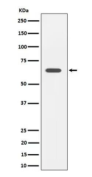 SOCS7 Rabbit mAb