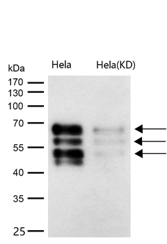 BIN1 Rabbit mAb [KD Validated]