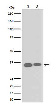 ELOVL5 Rabbit mAb