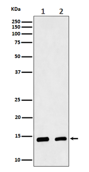 CRABP2 Rabbit mAb