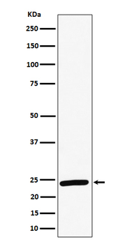 RAB8A Rabbit mAb