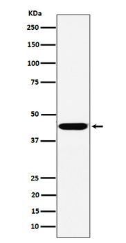 KCTD9 Rabbit mAb