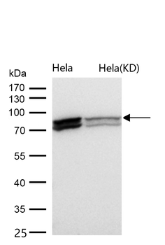 HNRNPM Rabbit mAb [KD Validated]