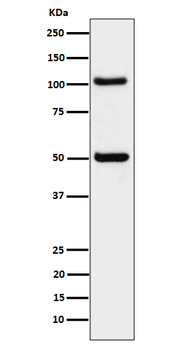 ORP1 Rabbit mAb [KD Validated] Antibody