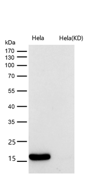 Histone H3 (acetyl K18) Rabbit mAb [KD Validated]