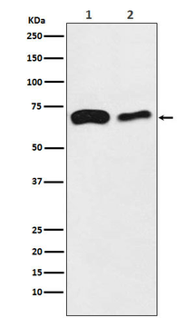 SLC27A4 / FATP4 Rabbit mAb