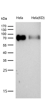Poliovirus Receptor Rabbit mAb [KD Validated]