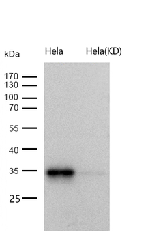 PRKRA Rabbit mAb [KD Validated]
