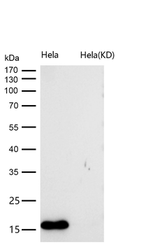 MTH1 Rabbit mAb [KD Validated]