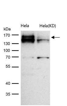 CLSTN1 Rabbit mAb [KD Validated]