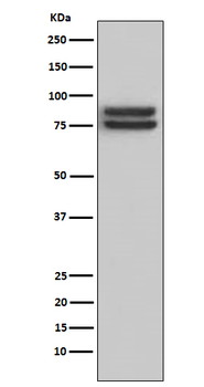 FOXP1 Rabbit mAb