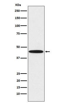 DDB2 Rabbit mAb
