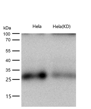 Bcl10 Rabbit mAb [KD Validated]