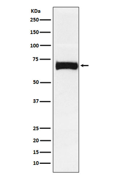 Nectin 2 Rabbit mAb